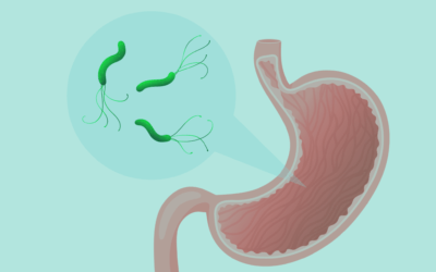 Blog Avellà Farmàcia en Oliva 8 Helicobacter pylori: qué es y cómo afecta a tu salud